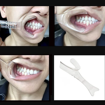 10Pcs Стоматологична прозрачна стоматологична отварачка за уста Y-тип Spat Hook Lip Cheek Retractor Зъболекарски инструменти Консумативна уста