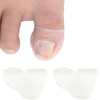 2pc Силиконов врастнал инструмент за корекция на ноктите на краката Невидим врастнал пръст нокти лечение еластични изправяне клип скоба педикюр инструмент