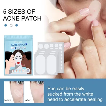 80Patches/Pack Acne Patch 5 Размери на акне кръпка хидроколоидна превръзка за акне кожата Blemish Remover грижа за кожата