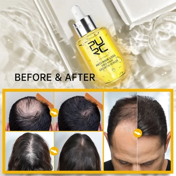 PURC Бърз растеж на косата за мъже Жени Джинджифил расте коса масло грижа против косопад скалпа лечение серум продукти красота здраве 2023